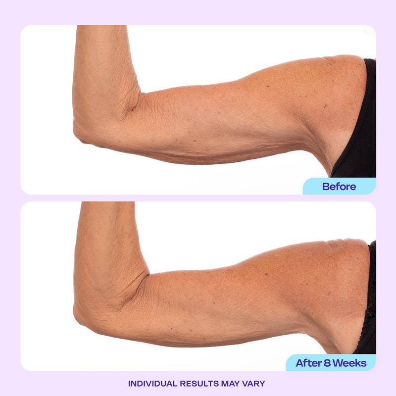 GOPURE Sculpt & Tone Arm Cream with 7% Protight Firming Complex & Ashwagandha Root Extract Daily Hydrating Moisturizer for Loose Skin Repair